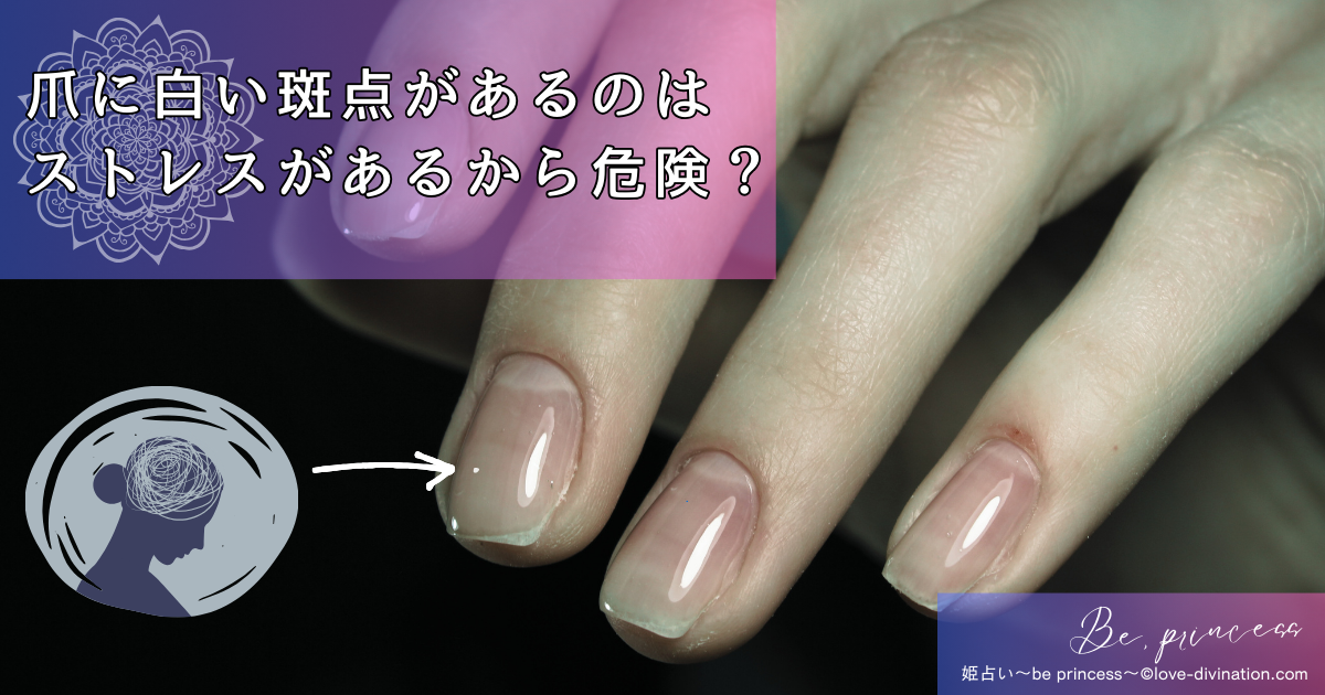 爪の白い斑点はどのように治療されますか?